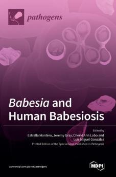 Babesia and Human Babesiosis