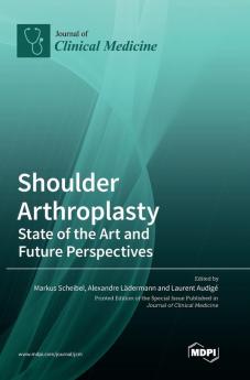Shoulder Arthroplasty