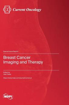 Breast Cancer Imaging and Therapy