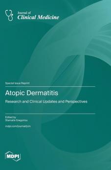 Atopic Dermatitis