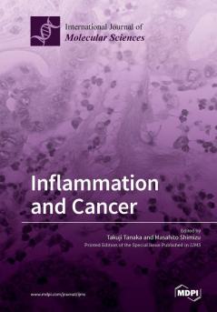 Inflammation and Cancer