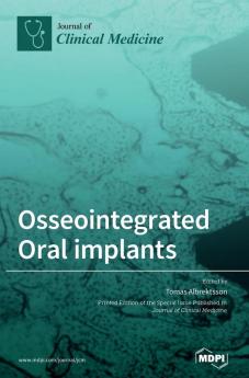 Osseointegrated Oral implants: Mechanisms of Implant Anchorage Threats and Long-Term Survival Rates