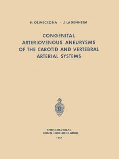 Two decades have elapsed since the publication of the earliest study from this clinic 13 concerning arteriovenous aneurysms. Although numerous communications , 36-40 have elaborated on our subsequent experiences with this lesion, it would appear justified and profitable at this time to further review the material and assess the results. Moreover, we shall attempt in this monograph to concentrate primarily upon our own clinical material, the largest series published to date, rather than prepare an exhaustive survey 63 of the literature. Attention is invited to the study of TÖNNlS and LANGE-COSACK , with which this series may be collated. Acknowledgements are herein made to other members of the clinic who have previously reported on this subject, from whose studies we have in several instances reproduced case histories. We express our thanks for the assistance rendered by Professor E. LlNDGREN. Drs. H. NORDENSTAM and O. HÖÖK were kind enough to place their services and advice at our disposal. To the Springer Publishing Company goes the gratitude of the authors for the interest, effort and cooperation attending the publication of this monograph.