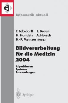Bildverarbeitung f��r die Medizin 2004
