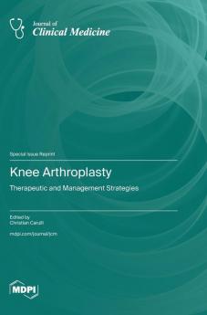 Knee Arthroplasty