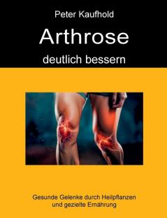 Arthrose deutlich bessern
