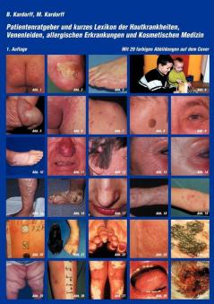 Patientenratgeber und kurzes Lexikon der Hautkrankheiten Venenleiden allergischen Erkrankungen und kosmetischen Medizin