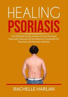 Healing Psoriasis: The Ultimate Guide on How to Cure Psoriasis Naturally Discover All the Natural Treatments For Psoriasis and Psoriatic Arthritis