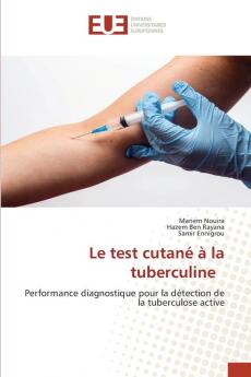 Le test cutané à la tuberculine