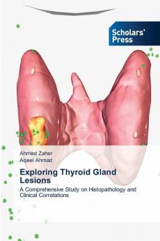 Exploring Thyroid Gland Lesions