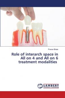 Role of interarch space in All on 4 and All on 6 treatment modalities