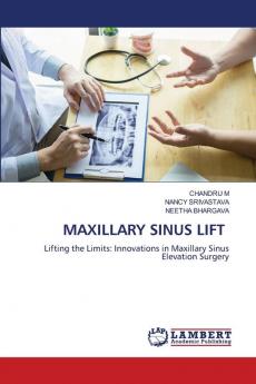 MAXILLARY SINUS LIFT