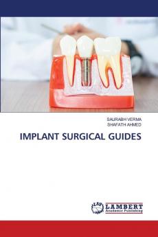 IMPLANT SURGICAL GUIDES