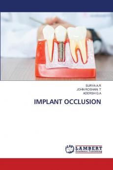 IMPLANT OCCLUSION