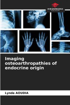 Imaging osteoarthropathies of endocrine origin