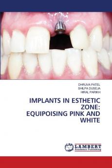 IMPLANTS IN ESTHETIC ZONE