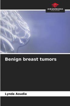 Benign breast tumors