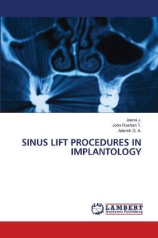 SINUS LIFT PROCEDURES IN IMPLANTOLOGY
