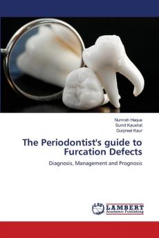 The Periodontist's guide to Furcation Defects