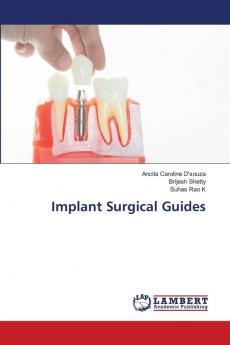 Implant Surgical Guides