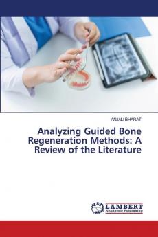 Analyzing Guided Bone Regeneration Methods