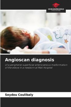 Angioscan diagnosis