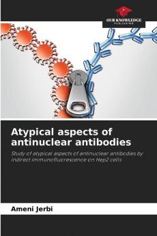 Atypical aspects of antinuclear antibodies