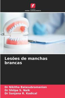 Lesões de manchas brancas