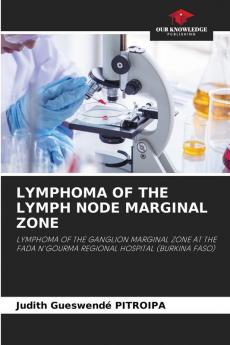 LYMPHOMA OF THE LYMPH NODE MARGINAL ZONE