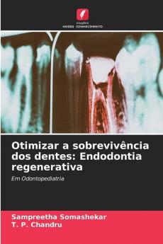 Otimizar a sobrevivência dos dentes