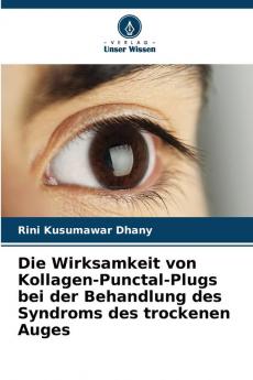 Die Wirksamkeit von Kollagen-Punctal-Plugs bei der Behandlung des Syndroms des trockenen Auges