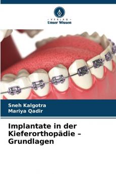 Implantate in der Kieferorthopädie - Grundlagen