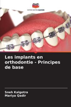 Les implants en orthodontie - Principes de base