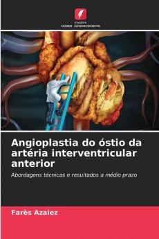 Angioplastia do óstio da artéria interventricular anterior
