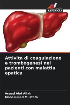 Attività di coagulazione e trombogenesi nei pazienti con malattia epatica