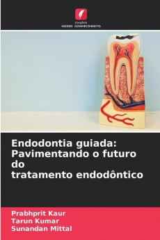Endodontia guiada