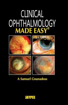 Clinical Ophthalmology Made Easy