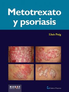 Metotrexato y psoriaris