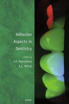 Adhesion Aspects in Dentistry