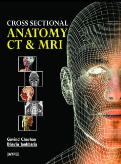 Cross Sectional Anatomy CT and MRI