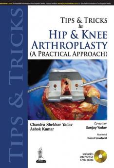 TIPS & TRICKS IN HIP & KNEE ARTHROPLASTY (A PRACTICAL APPROACH)