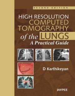 HIGH RESOLUTION COMPUTED TOMOGRAPHY OF THE LUNGS A PRACTICAL GUIDE