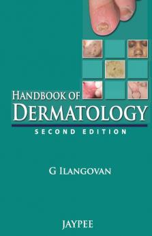HANDBOOK OF DERMATOLOGY