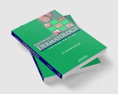 HANDBOOK OF DERMATOLOGY