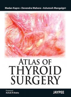 ATLAS OF THYROID SURGERY