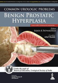 (PA) COMMON UROLOGIC PROBLEMS BENIGN PROSTATIC HYPERPLASIA-     1/e