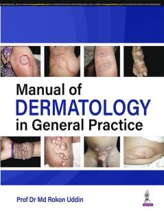 Manual of Dermatology in General Practice