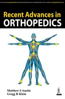 RECENT ADVANCES IN ORTHOPEDICS