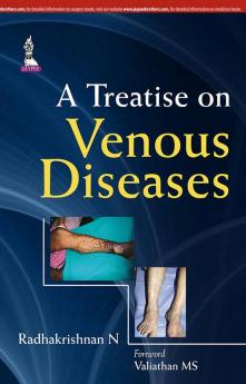 A Treatise On Venous Diseases