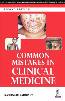 COMMON MISTAKES IN CLINICAL MEDICINE